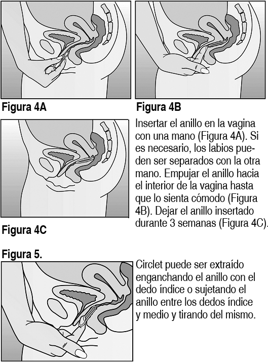 CIRCLET Anillo Vaginal